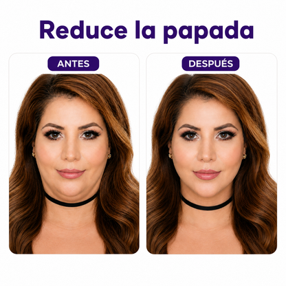 Complejo Linfático