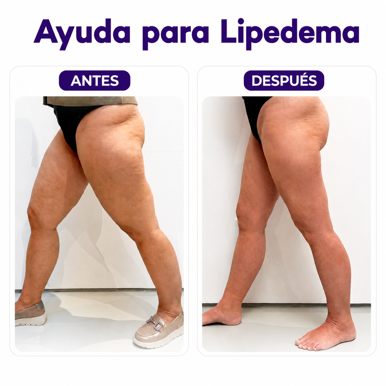 Complejo Linfático