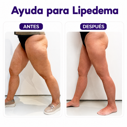Complejo Linfático